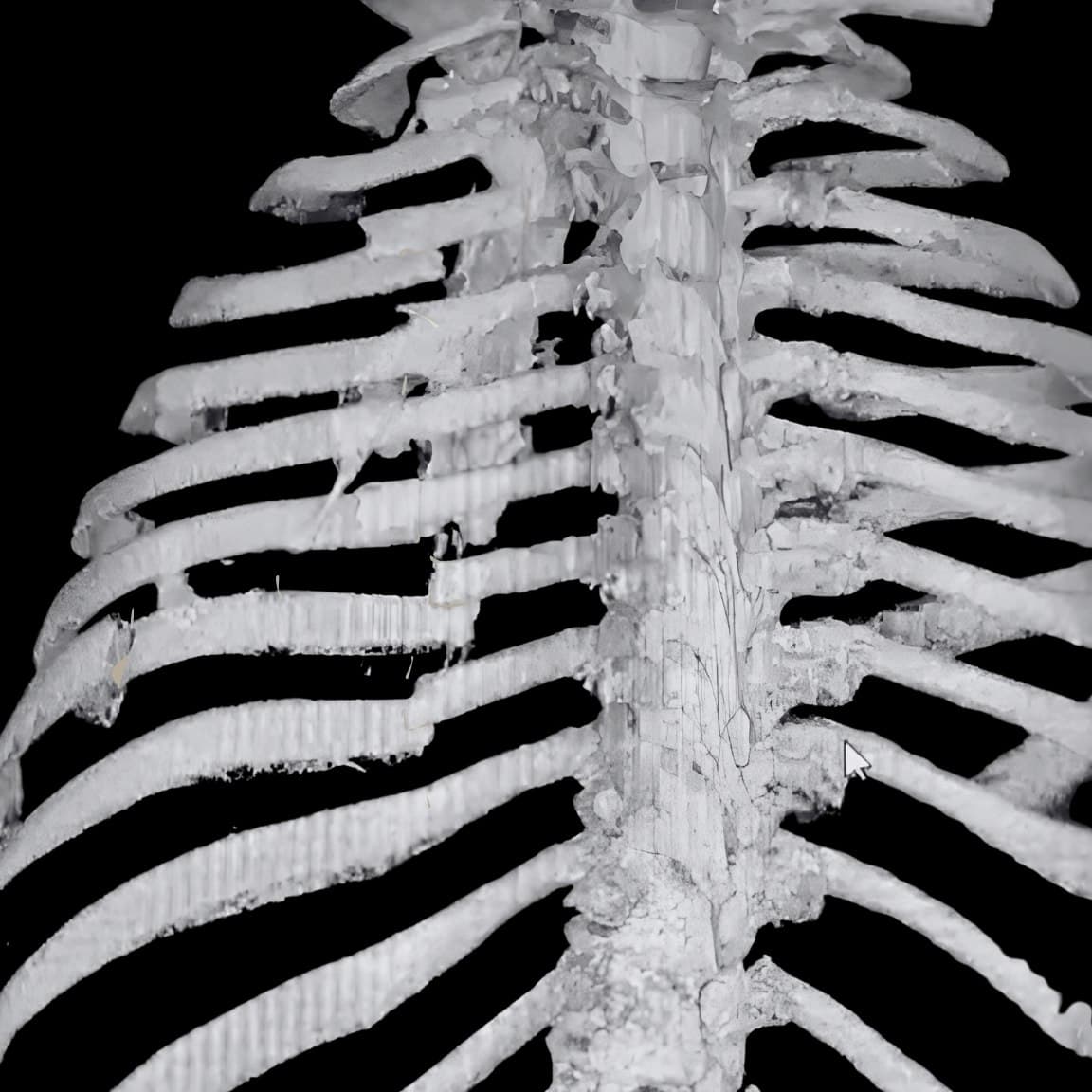 CT-Scan Dr. Ribs — 14 Rippenbrüche als Rinder-Tierarzt im Stall